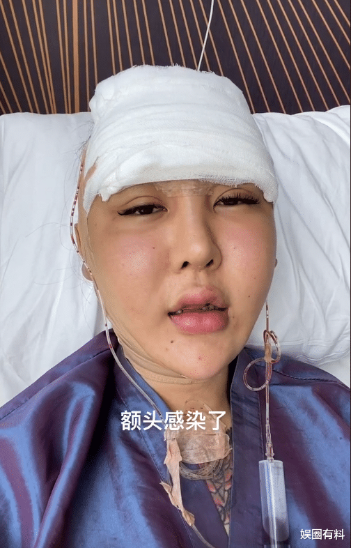 整容|人造美女“桃花宝宝”，8年整容连亲妈都快认不出，她到底图啥？