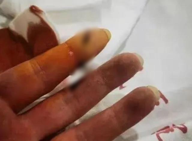 中国交通广播 隔着屏幕都疼！不敢看……