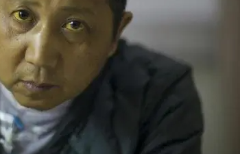 医线天|山东一男子，腹痛就医，确诊肝癌，医生怒斥：这3物怎能当饭吃