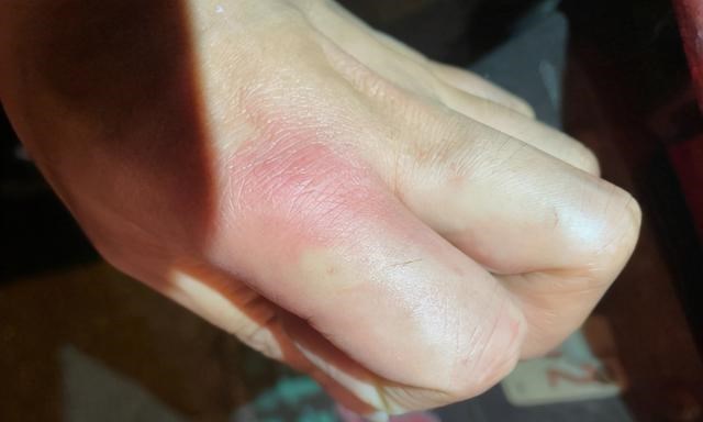 江苏省|江苏男子钓黄颡鱼回家吃，鱼肚里剖出条蜈蚣来，网友：一起煮了