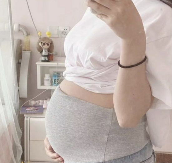 夏小可育儿|要记牢！不想让妊娠纹毁了肚子，科学预防“四重奏”一个都不能落