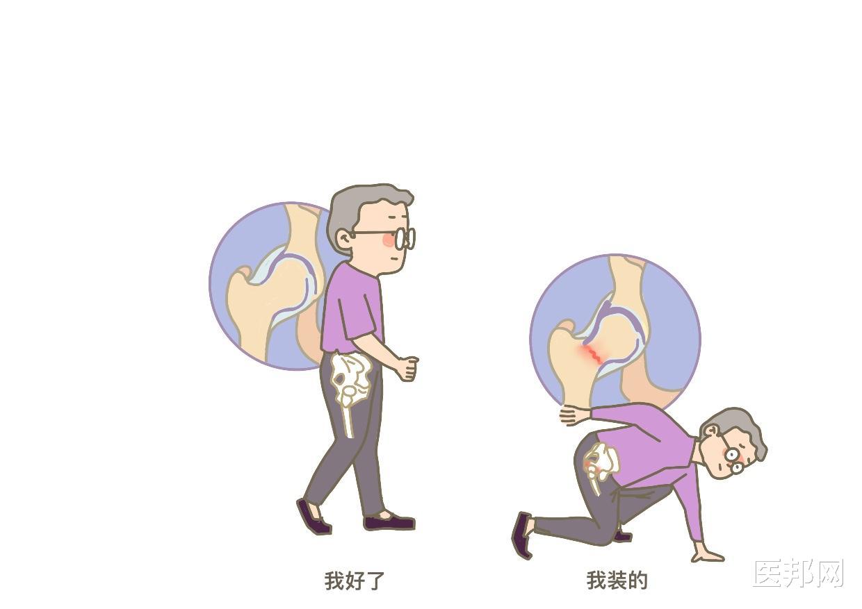 骨关节炎|天气变冷，关节炎频繁发作怎么办？骨关节炎的10大误区你知道吗？