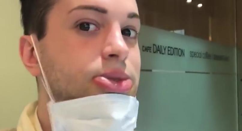 舜网 外国小伙整容40次，沉迷变成精灵，网友：为啥外国人口少