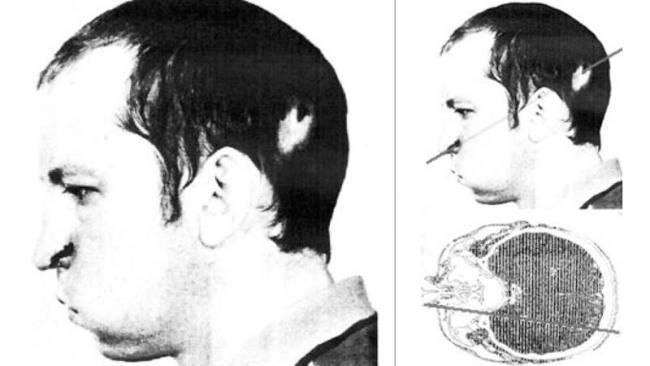 苏联物理学家曾将头伸进粒子加速器,被爆头后为何幸运活了下来?
