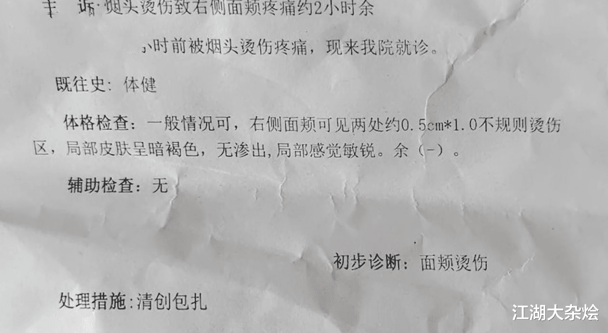 年会|陕西西安1公司高管组织年会，用烟头烫下属脸：疼是让你长记性