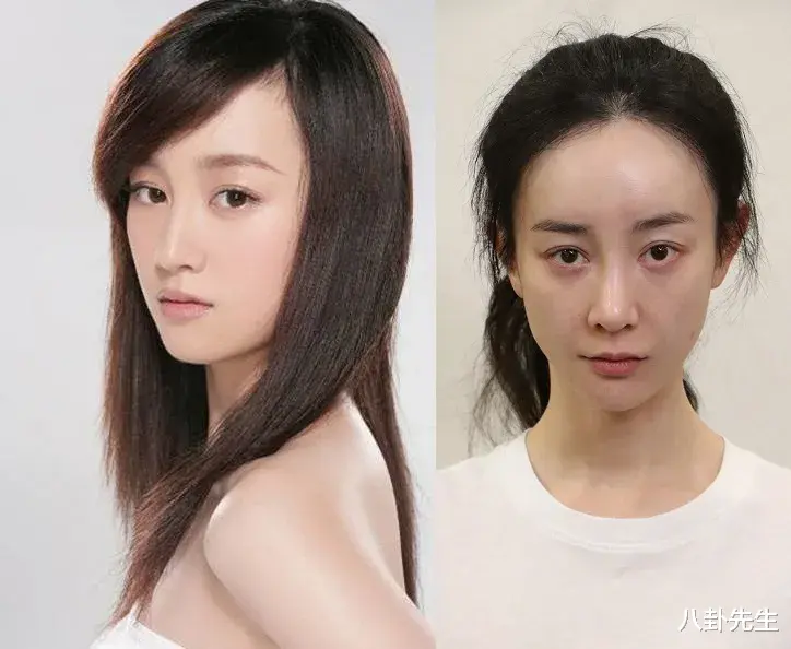 张萌|明明已经挺漂亮，却非要折腾脸的7大女星