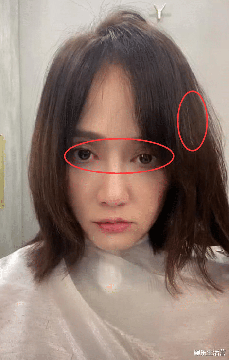 陈乔恩|42岁陈乔恩大病初愈，眼眶凹陷瘦脱相，网友：这怕是整了个容