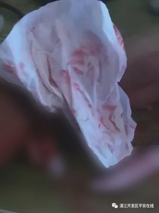 湛江生活网 一男子为情所困割腕失联，湛江警方连夜搜救，结果....