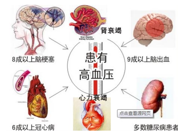 高血压疫苗|高血压疫苗即将上市，打一针还用吃降压药吗？听听医生的答案