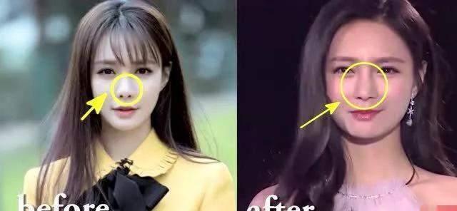 王一博|王一博鼻子透光引热议，医生曾指其缩鼻翼，多位明星因此被疑整容