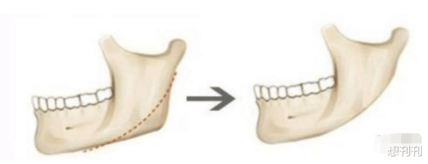 杨幂|那些一刀切削骨的明星还好吗？后遗症一大堆，小方脸成最大赢家