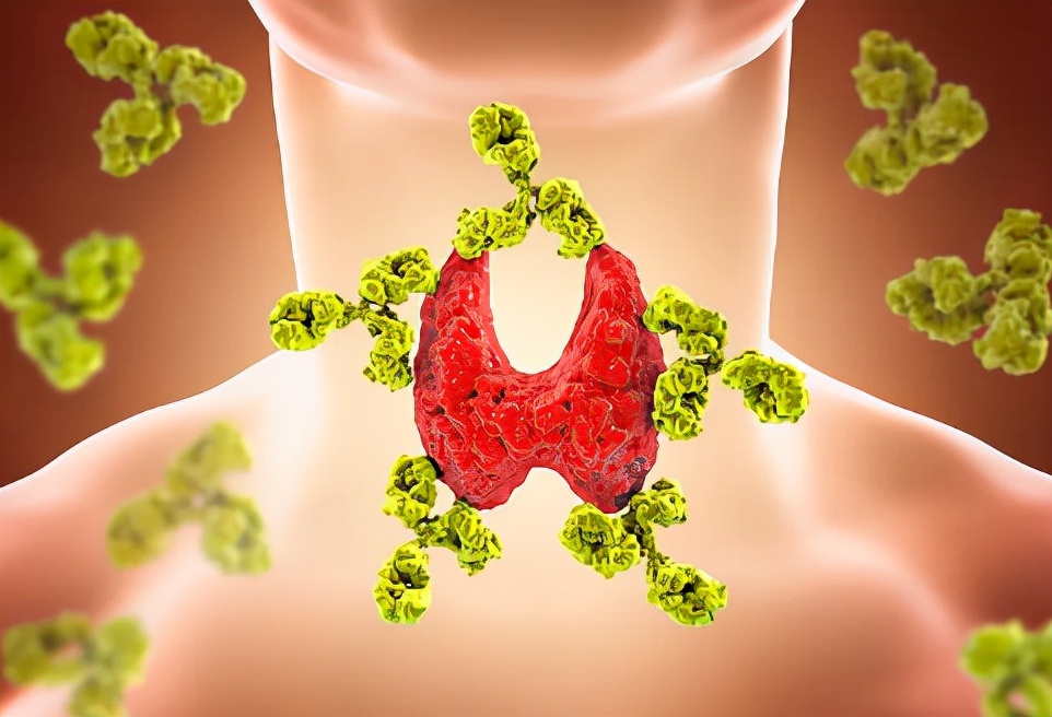 洋葱|转告家人:除“碘盐”外,有甲状腺病的人,这3种水果白送也不要吃