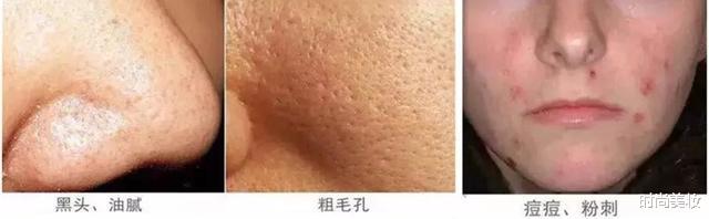 护肤|42岁李小冉皮肤白嫩自带“滤镜”，护肤秘诀大公开：几十块钱就够了