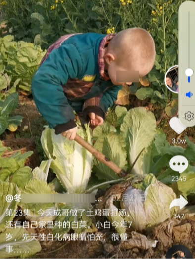 育儿宝屋|我有遗传病但坚持生了五胎：一个白化病、一个唇腭裂、一个精神病