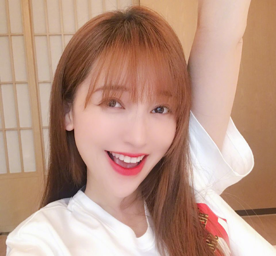 唇膏|金莎患麦粒肿，网友：自带眼影，生病都很漂亮