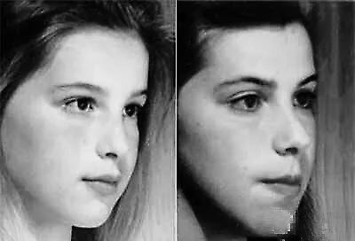 小儿推拿杨晓|小儿推拿杨晓：儿童腺样体肥大越来越多，治腺样体肥大中医有优势