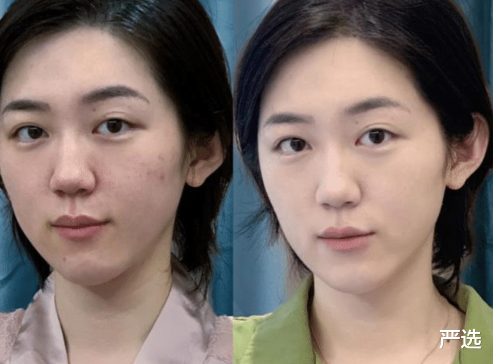 严选|李佳琦最近晒出一款乳膏，一瓶不到50块，堪称去角质中的扛把子