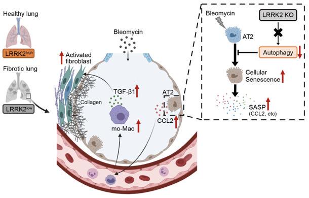 清华大学医学院揭示调控肺纤维化发病进程的新机制