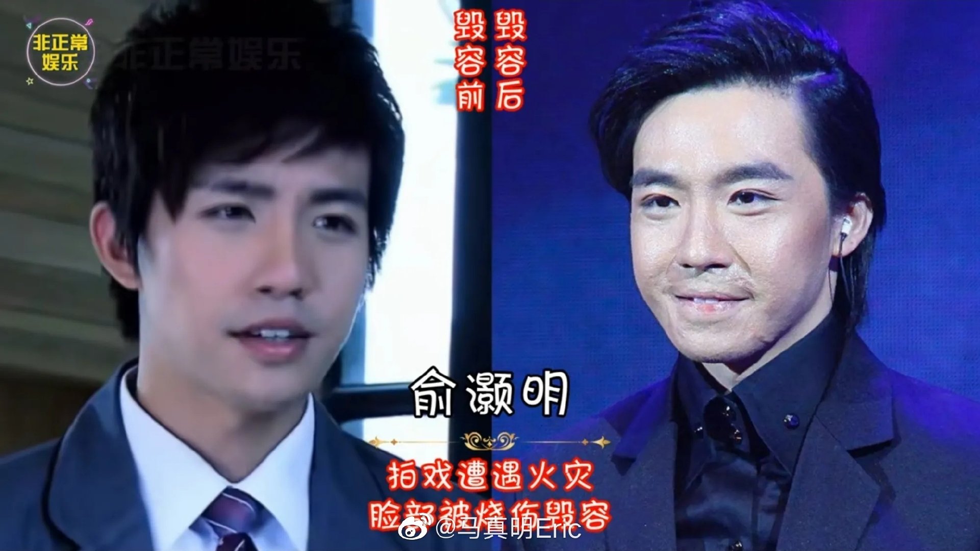 谢孟伟|五位明星意外毁容，最后一个却意外好看。