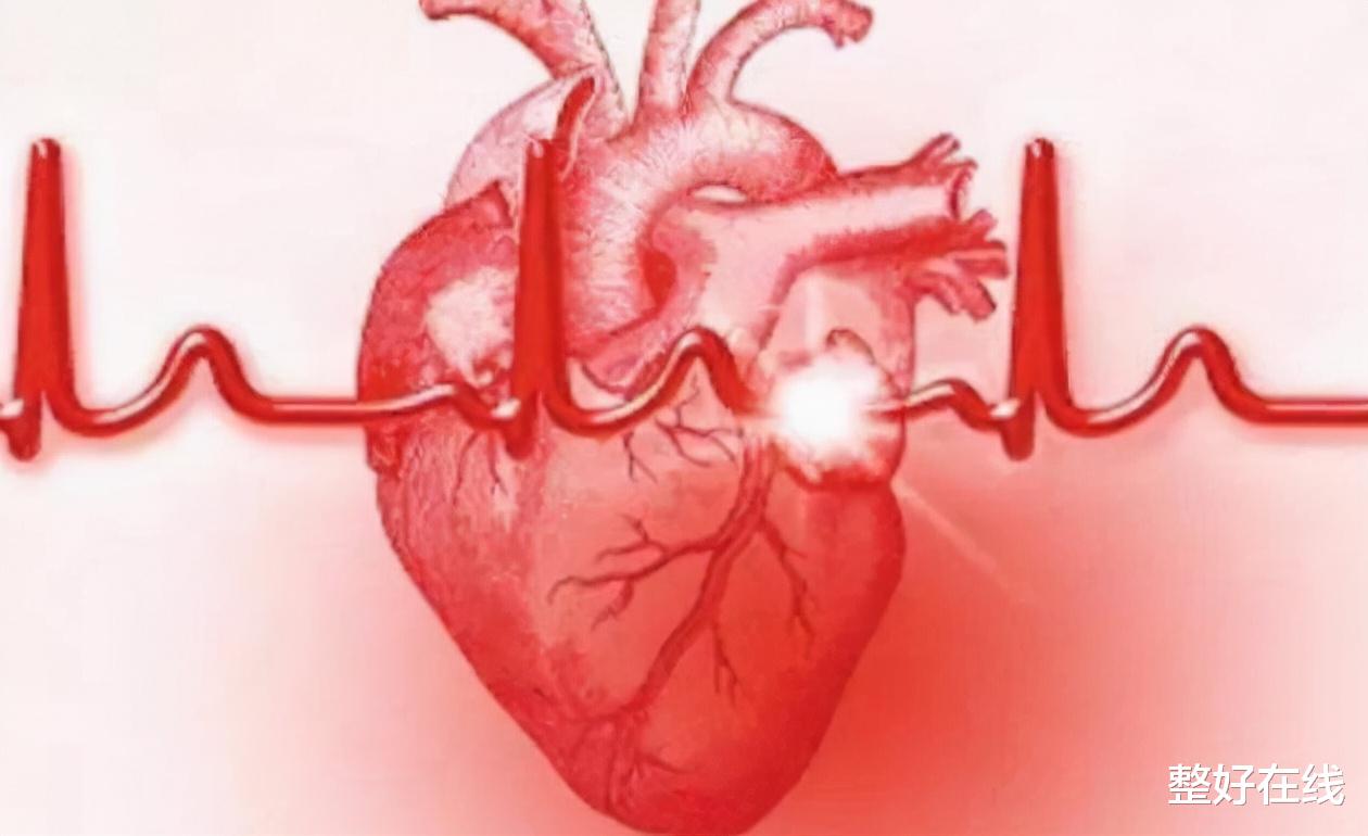 整好在线 猝死概率不断增加，实际上是发生了心肌梗死？要警惕这4个情况