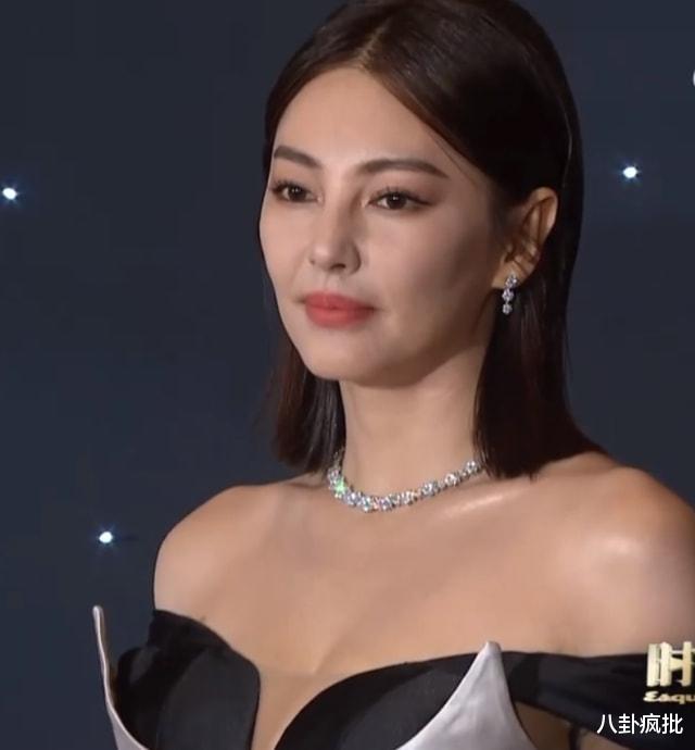 张雨绮|张雨绮脸僵鼻子怪，过度医美惹的祸？