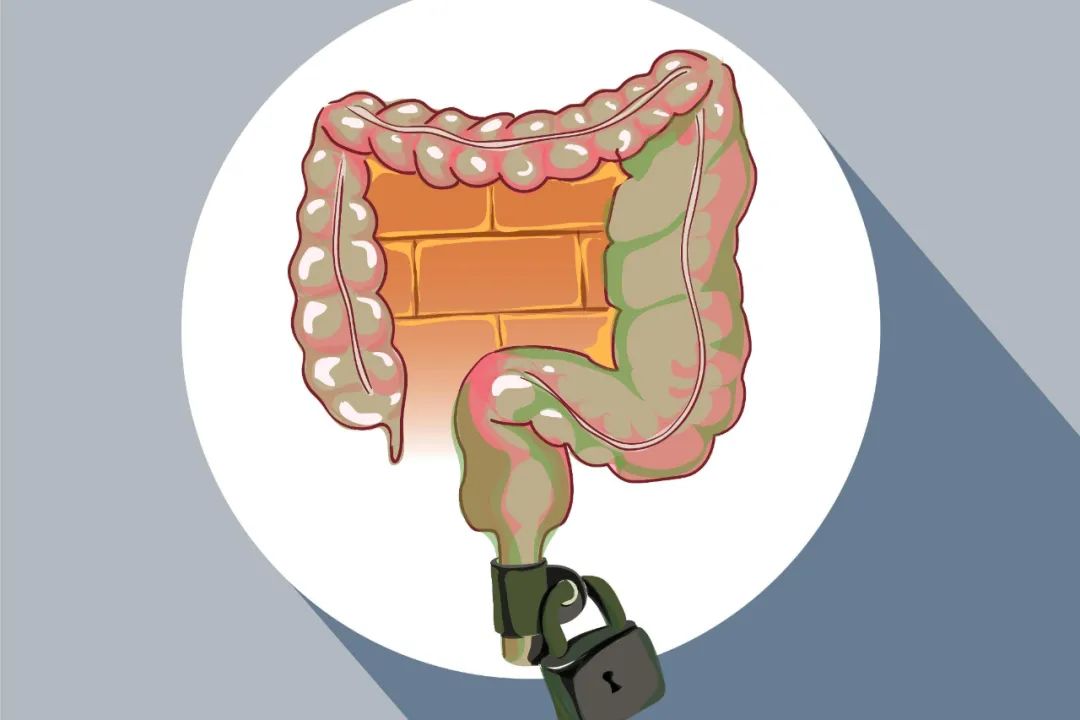 运动|患有肠息肉不能拖，若大便有这3种异常，当心肠息肉已经发生病变