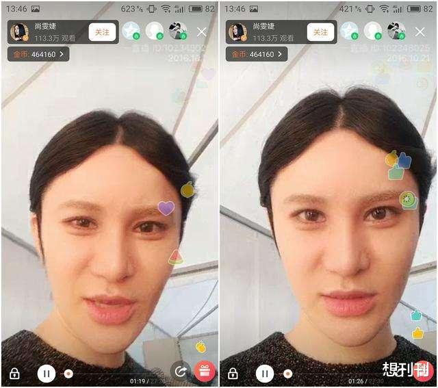 整形|明星的N种“假下巴”，尖到戳死人，翘成老巫婆，一个比一个怪异