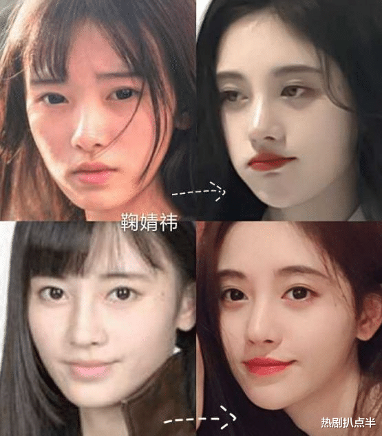 袁冰妍|90后小花的动脸史,有5人“换头改命”,金晨的鼻孔却越来越小
