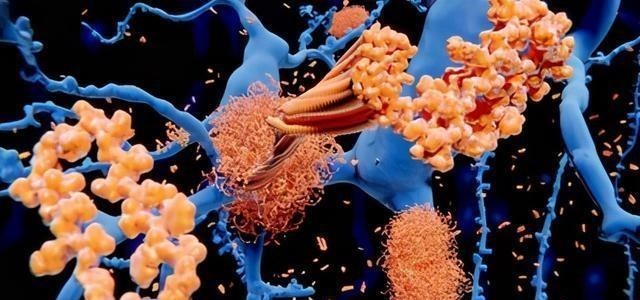 基因 人类20号染色体上，特殊的基因，致死率100%的朊病毒到底是啥？