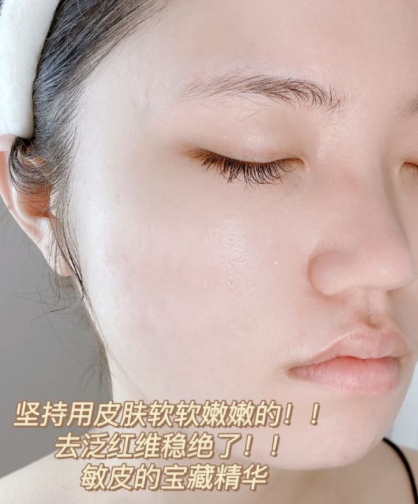 黑色素 想变白！只要坚持做好这件事，比几千块的护肤品更有效！