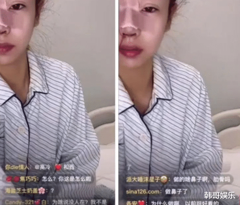整容|兮妹再次整容，面部吓人！次惑小仙女斥责前男友得不到我就黑我