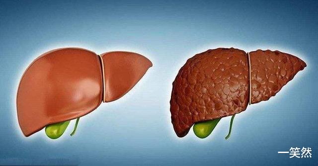 蔬菜|男性晨起的3个行为,比喝酒更伤肝,应及时远离