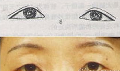 生辰八字|眼睛看相 三角眼的运势