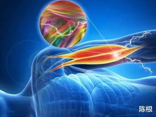 自然 陈根：新型制动器，兼具高电活性和耐久性