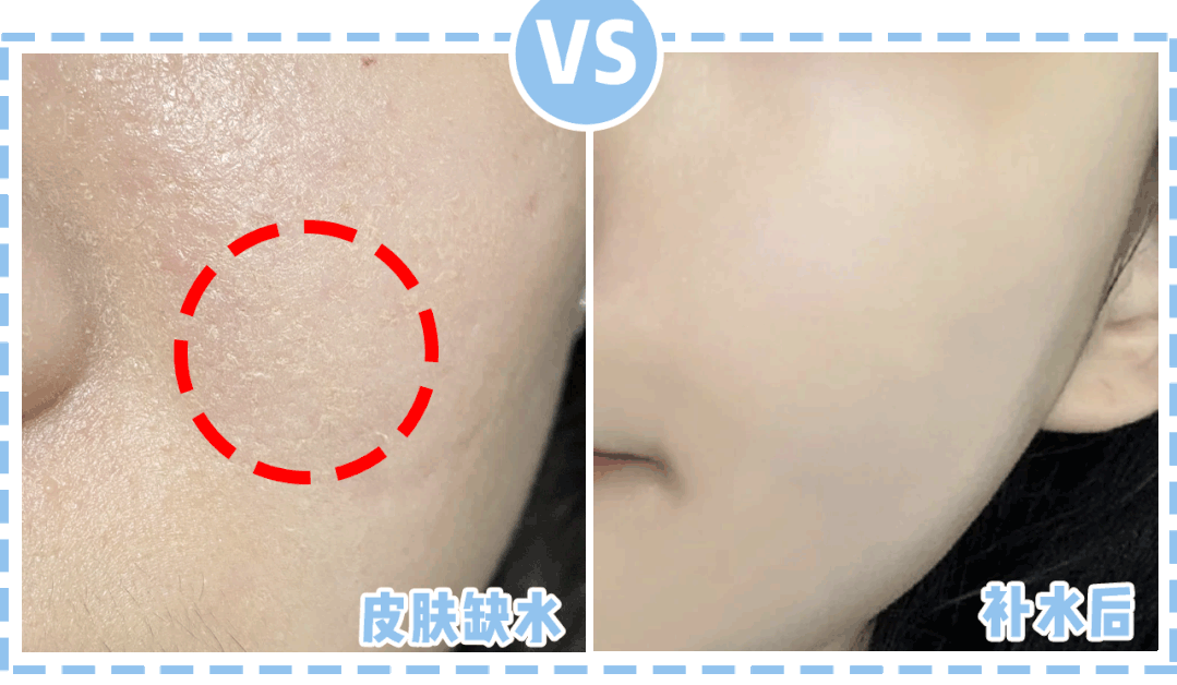 冻龄 不老女神赵文琪的冻龄秘诀原来是“它”，用后保湿嫩肤显年轻，却因价低不被重视