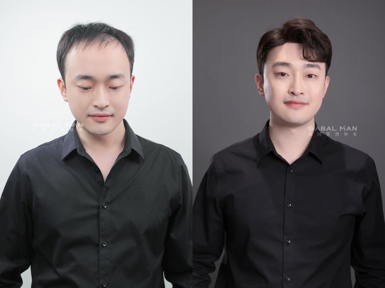 GabalMan贾博补发|古埃及人剃光头、戴假发，原来真不是多此一举！