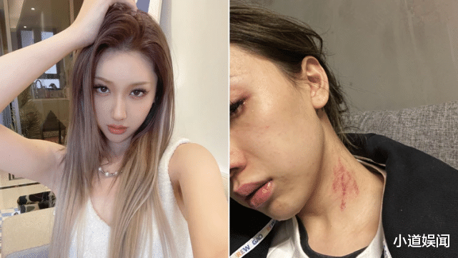 FreeC|出轨家暴染病!知名女星怒揭遭艺人男友PUA,崩溃大哭视频曝光!