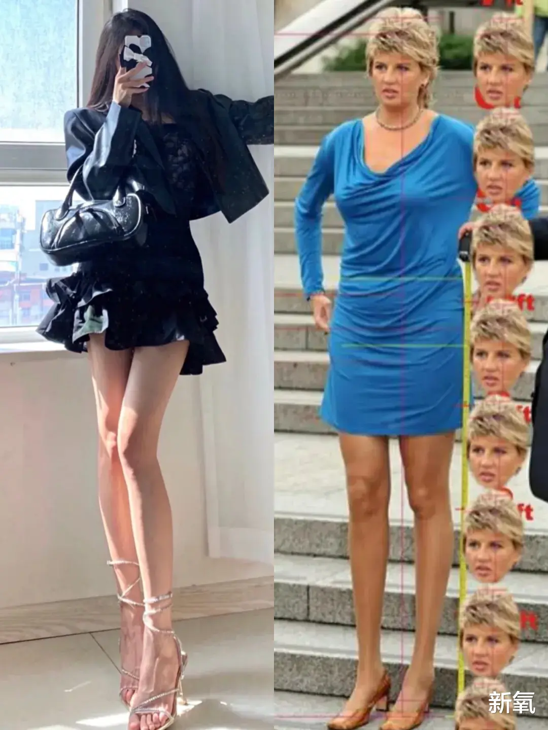 肠镜|追求过度的审美畸形，把腿p再长也有破绽