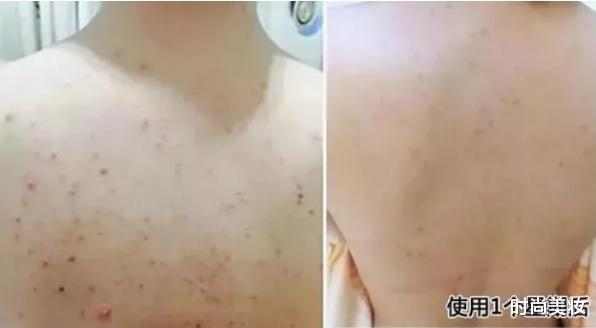 护肤|李小冉皮肤开挂了！堪称“合照杀手”，坦言：护肤只需做好一件事