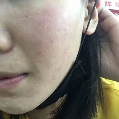 防晒|“黄脸婆”逆袭辣妈记！孕期护肤坚持“三不要”，胎宝才能长得好