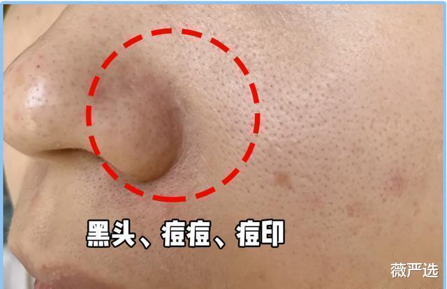 卫衣 我国有一款“不起眼”爽肤水，却能有效保湿嫩肤，只因价低被无视