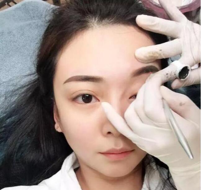 纹眉|那些纹眉的女生,如今怎样了?过来人讲出亲身经历,要多加重视了