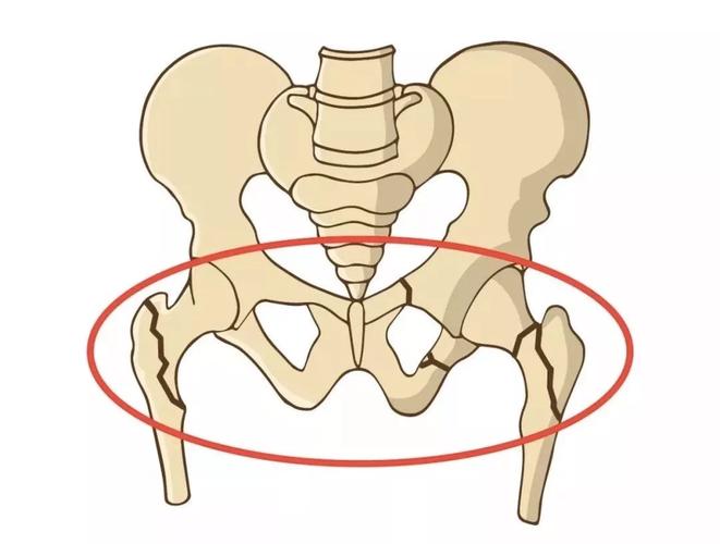 水果|骨骼“保护剂”被挖出，不是牛奶和钙片，很多人不当回事，可多食