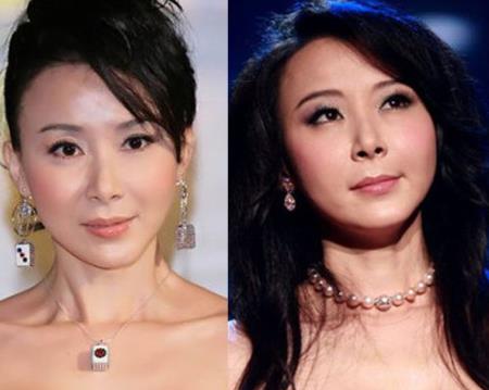 整容|脸成发面团，下巴能犁地？中老年女明星整容后遗症才是“重灾区”