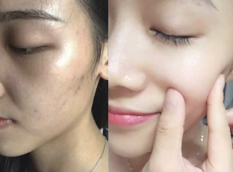 停留在指尖的幸福 继“百雀羚”后,中国又一“平价”精华液走红!效果力压兰蔻