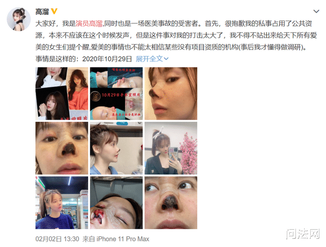 问法网 女演员整容失败鼻尖坏死，律师告诉你医美背调如何做