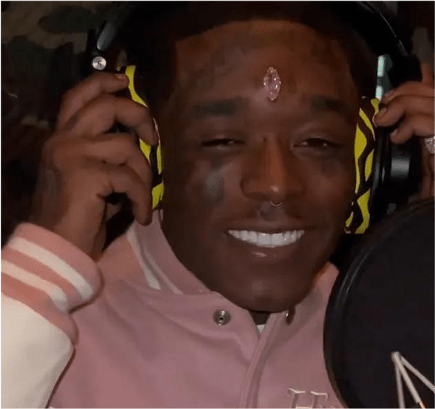 |27岁男歌手额头镶价值1.5亿粉钻，4个月后伤口发炎被迫摘掉，留下大疤