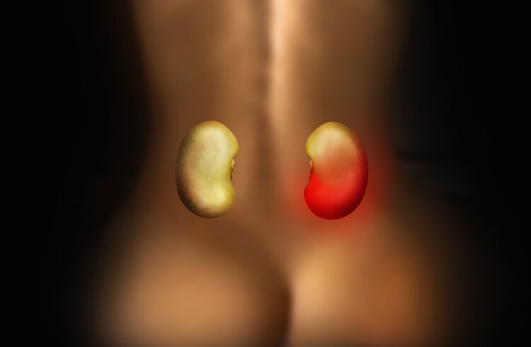 肾衰竭|?肾衰竭“刚萌芽”时，身体隐约有4个反常，别硬撑到“尿毒症”