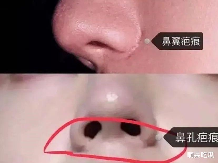 王一博|24岁王一博老太快！整容医生一语道出真相：动过鼻子的后遗症