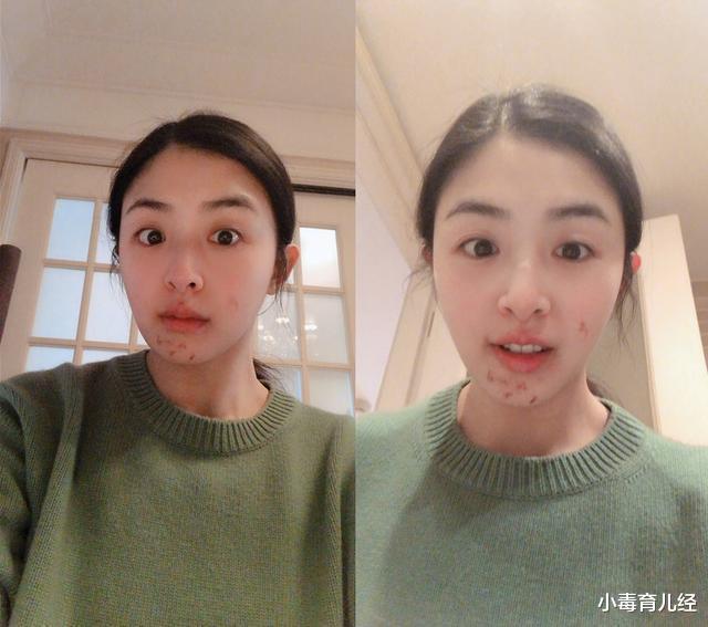 张含韵|张含韵坚持大半年，最终减肥成功，一起来看看她是如何做到的